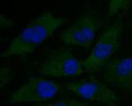 alpha Actinin Monoclonal Antibody (A1G2)
