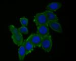 RUVBL2 Monoclonal Antibody (A1F1)