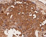 LYRIC Antibody in Immunohistochemistry (Paraffin) (IHC (P))