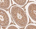 LYRIC Antibody in Immunohistochemistry (Paraffin) (IHC (P))
