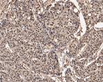 UBA3 Antibody in Immunohistochemistry (Paraffin) (IHC (P))