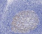 DNMT1 Monoclonal Antibody (A3A9)