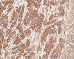 Cytokeratin 20 Monoclonal Antibody (A3D12)