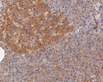 CASK Monoclonal Antibody (A1C7)