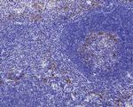 CHI3L1 Monoclonal Antibody (A3G10)