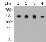 CLSTN1 Antibody in Western Blot (WB)