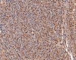 PSMA2 Antibody in Immunohistochemistry (Paraffin) (IHC (P))