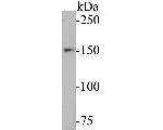 WRN Recombinant Rabbit Monoclonal Antibody (JE52-72)