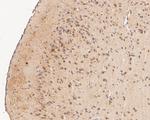 Tropomodulin 2 Antibody in Immunohistochemistry (Paraffin) (IHC (P))
