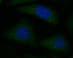 KIFAP3 Recombinant Rabbit Monoclonal Antibody (JE52-70)