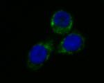 LDHD Antibody in Immunocytochemistry (ICC/IF)