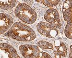 LDHD Antibody in Immunohistochemistry (Paraffin) (IHC (P))