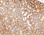 LDHD Antibody in Immunohistochemistry (Paraffin) (IHC (P))