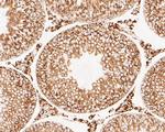 LDHD Antibody in Immunohistochemistry (Paraffin) (IHC (P))