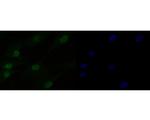 HMGN2 Recombinant Rabbit Monoclonal Antibody (JE53-85)