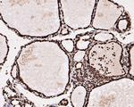 HMGN2 Antibody in Immunohistochemistry (Paraffin) (IHC (P))