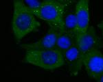 ECM1 Recombinant Rabbit Monoclonal Antibody (JE54-17)
