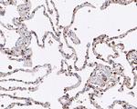 ABI2 Antibody in Immunohistochemistry (Paraffin) (IHC (P))