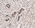 MGMT Antibody in Immunohistochemistry (Paraffin) (IHC (P))