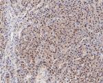 MGMT Antibody in Immunohistochemistry (Paraffin) (IHC (P))