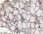 MGMT Antibody in Immunohistochemistry (Paraffin) (IHC (P))