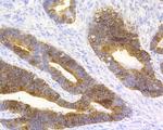 Cytokeratin 20 Recombinant Rabbit Monoclonal Antibody (JE20-39)