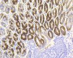 Cytokeratin 20 Antibody in Immunohistochemistry (Paraffin) (IHC (P))