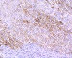 Villin Recombinant Rabbit Monoclonal Antibody (JE39-08)