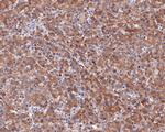 Neurocan Recombinant Rabbit Monoclonal Antibody (JE54-15)