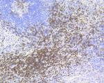 CD3 epsilon Antibody in Immunohistochemistry (Paraffin) (IHC (P))