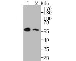 DOK1 Recombinant Rabbit Monoclonal Antibody (JE54-52)