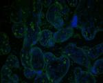 GAA Recombinant Rabbit Monoclonal Antibody (JE54-59)