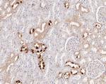 EphB3 Antibody in Immunohistochemistry (Paraffin) (IHC (P))