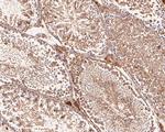 VEGFD Antibody in Immunohistochemistry (Paraffin) (IHC (P))