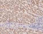 DPYD Recombinant Rabbit Monoclonal Antibody (JE54-79)