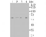 LGI1 Recombinant Rabbit Monoclonal Antibody (JE54-88)