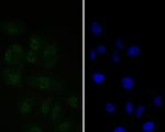 Tat-SF1 Recombinant Rabbit Monoclonal Antibody (JE54-89)