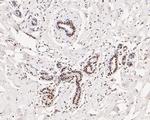 Tat-SF1 Antibody in Immunohistochemistry (Paraffin) (IHC (P))