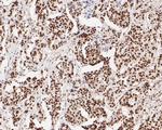 Tat-SF1 Antibody in Immunohistochemistry (Paraffin) (IHC (P))