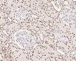 XPD Antibody in Immunohistochemistry (Paraffin) (IHC (P))