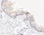 XPD Antibody in Immunohistochemistry (Paraffin) (IHC (P))