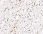 XPD Antibody in Immunohistochemistry (Paraffin) (IHC (P))