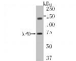 XPD Antibody in Western Blot (WB)