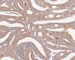 VPS28 Antibody in Immunohistochemistry (Paraffin) (IHC (P))