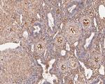 VPS28 Antibody in Immunohistochemistry (Paraffin) (IHC (P))