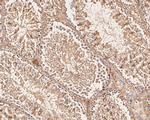 VPS28 Antibody in Immunohistochemistry (Paraffin) (IHC (P))