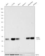 VPS28 Antibody in Western Blot (WB)