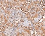 RANBP9 Antibody in Immunohistochemistry (Paraffin) (IHC (P))