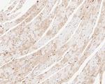 RANBP9 Antibody in Immunohistochemistry (Paraffin) (IHC (P))