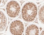 RANBP9 Antibody in Immunohistochemistry (Paraffin) (IHC (P))